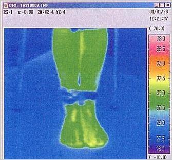 ⑥サーモグラフティーによる礒谷式脚結束法効果