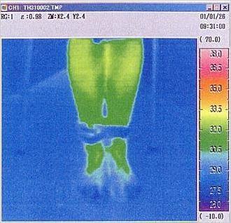 ②サーモグラフティーによる礒谷式脚結束法効果