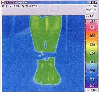 ④サーモグラフティーによる礒谷式脚結束法効果