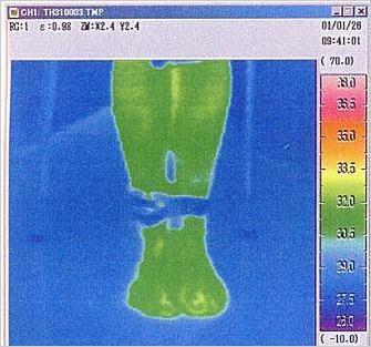 ③サーモグラフティーによる礒谷式脚結束法効果