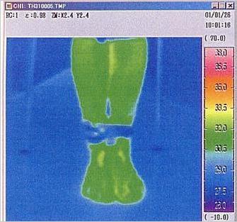 ⑤サーモグラフティーによる礒谷式脚結束法効果